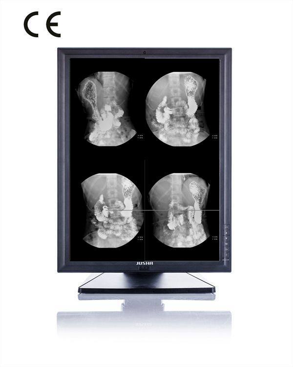 2MP 1600X1200 LED Screenmonitor for X Ray Equipment, CE