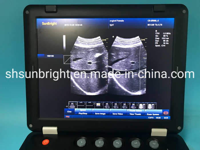 Ultrasound Scanner Machine Doppler 4D Scan Fetal Image Medical Scanner