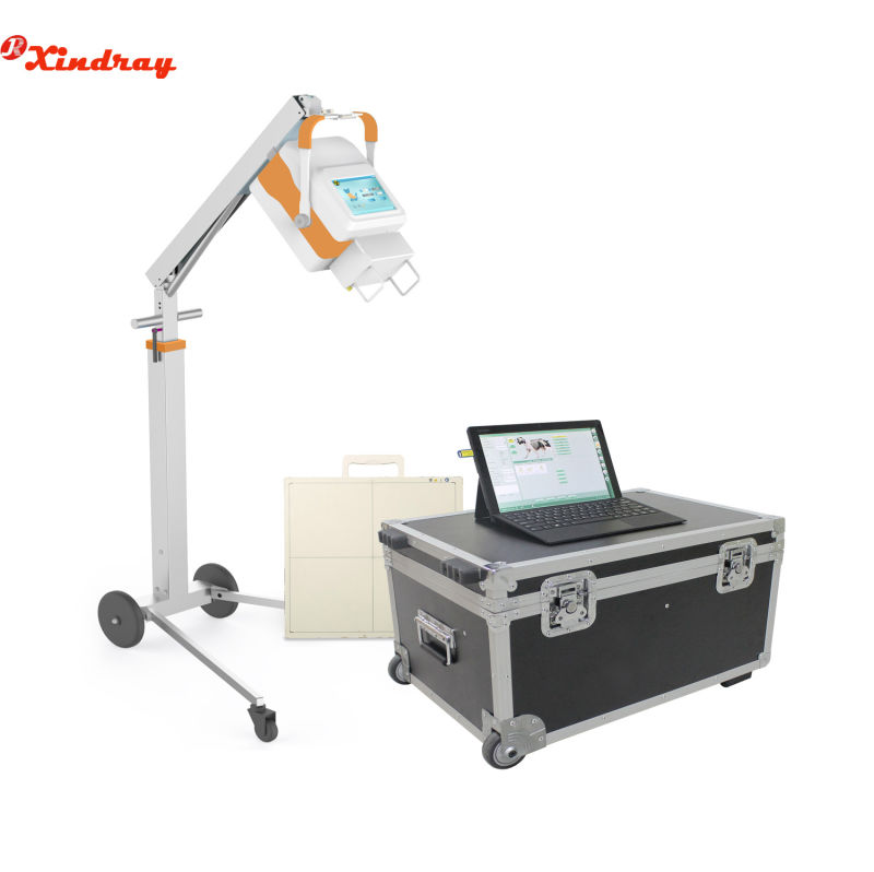 Hospital Equipment 5kw 100mA Mobile X-ray Machine