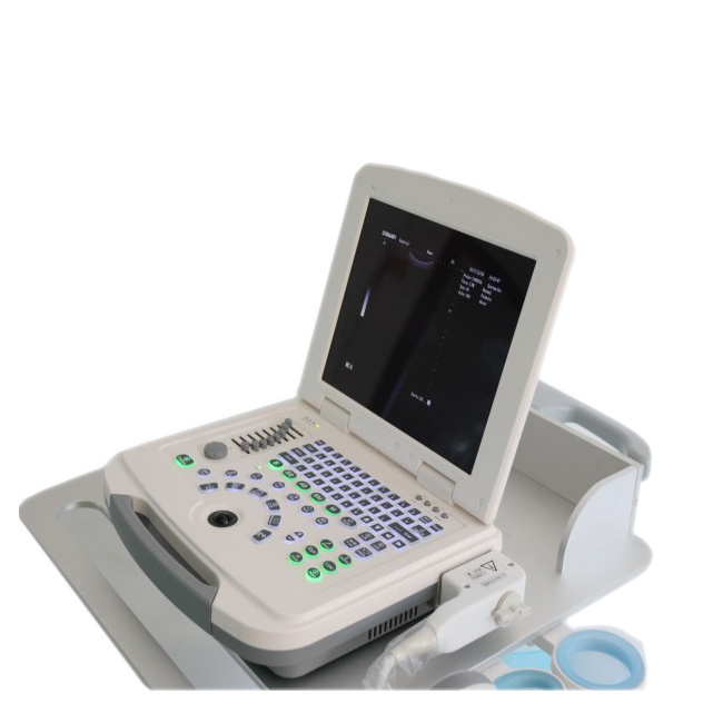 China Medical with USB Ultrasound Scanner Medical Imaging Scannner