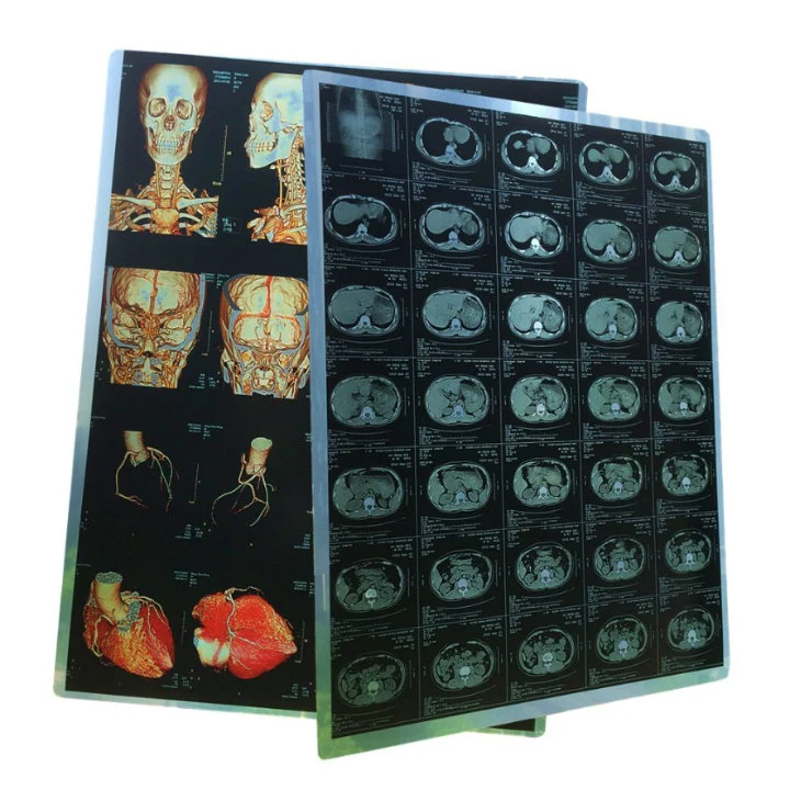 Laser X Ray Blue Film 10X40cm for CT Scan