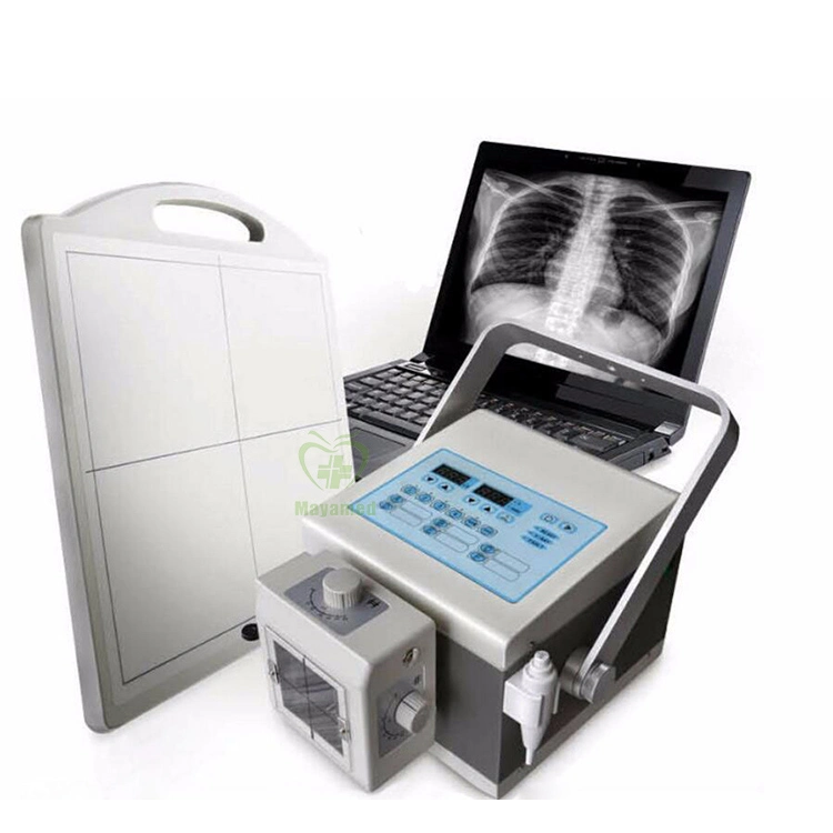 My-D019A Medical Diagnosis Equipment Digital Portable X-ray Machine Price