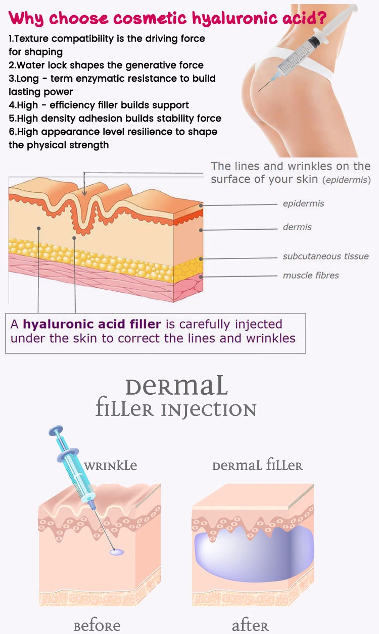 Hyaluronic Acid Benefits Buttocks Augmentation Dermal Filler 50ml Injection