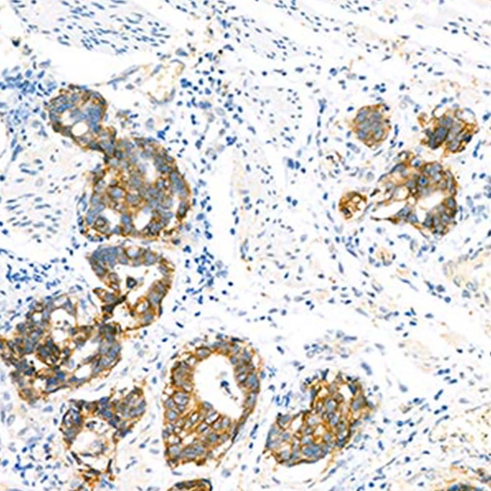 Primary Polyclonal Antibody Anti -Li Cadherin Rabbit Pab