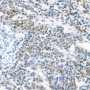 Mouse Monoclonal Primary Antibody Anti -Hsp60