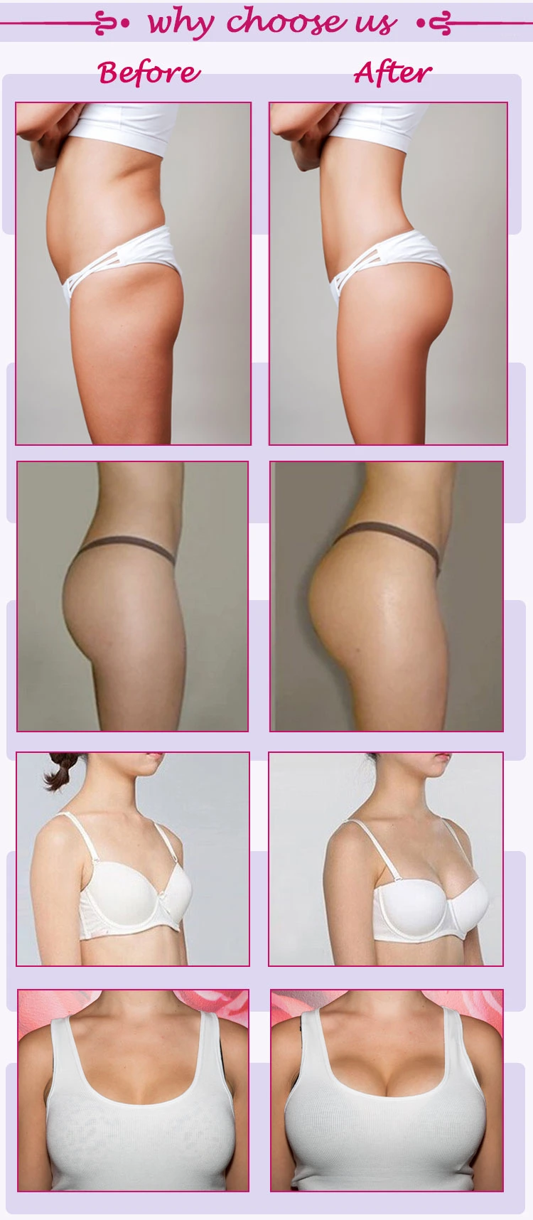 Hyaluronic Acid Benefits Buttocks Augmentation Dermal Filler 50ml Injection
