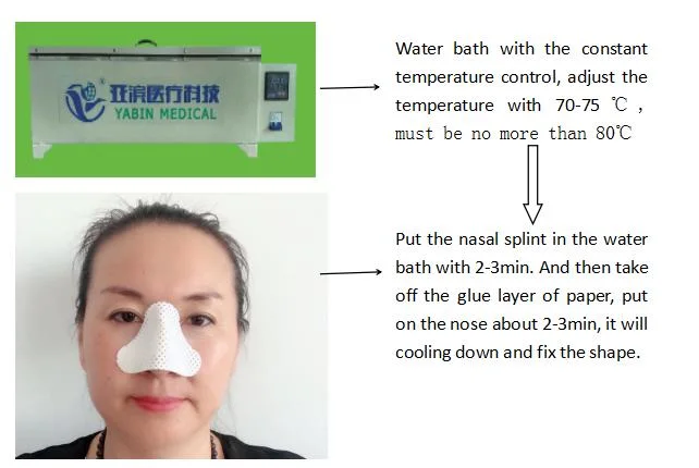 Thermoplastic Nasal Splint Sheets with CE ISO13485