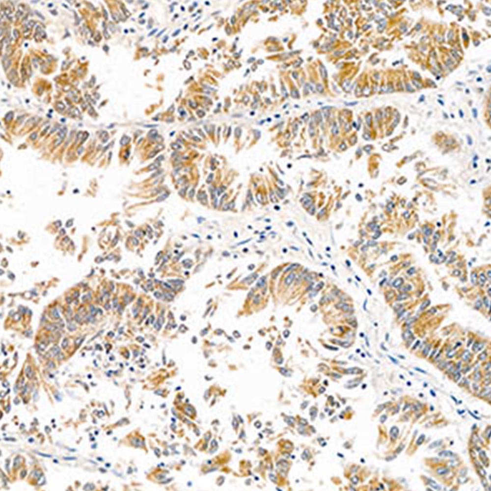 Mouse Monoclonal Primary Antibody Anti -Hsp60