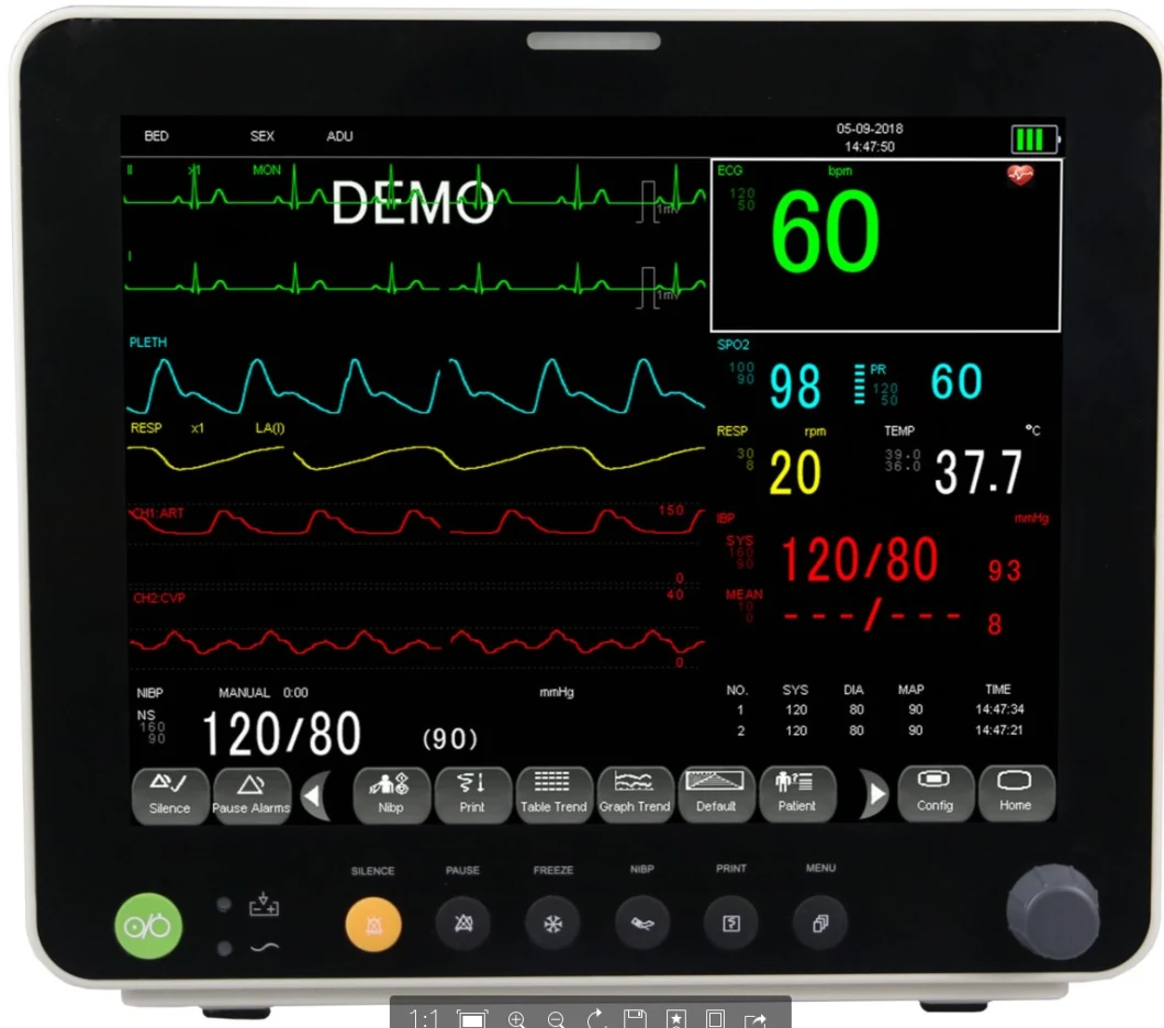 Ambulance 12.1 Inch Patient Monitor Multi-Parameter Patient Monitor