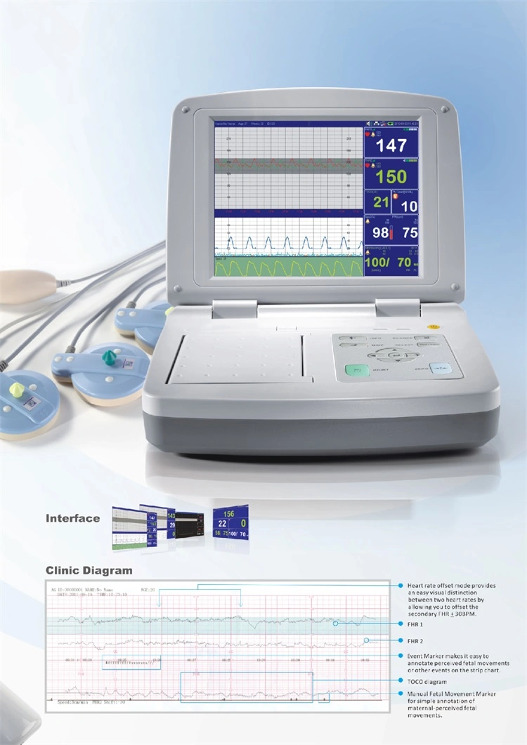 Medical Equipment ECG/NIBP/SpO2 Portable Fetal Maternal Heart Rate Monitor