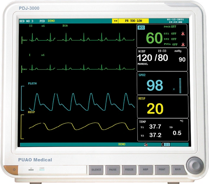 Most Popular Touch-Screen Multi-Parameter Patient Monitor with Ce Approved