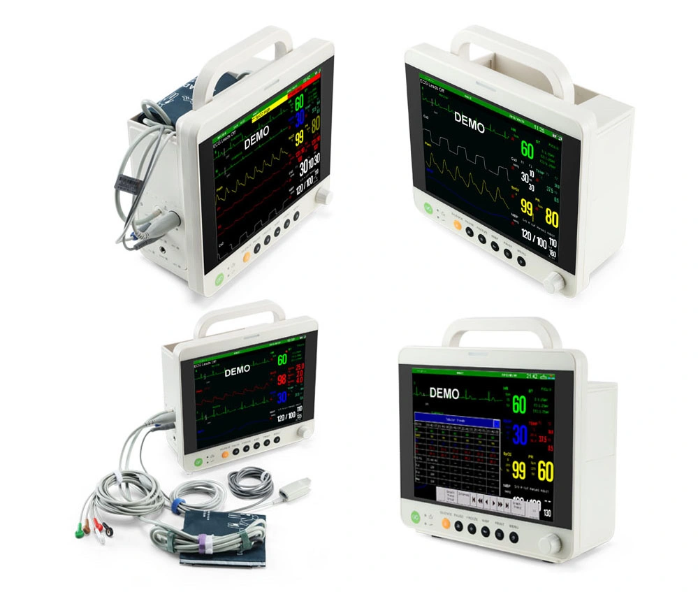 Vitals Signs Veterinary Monitor, Veterinary Vital Signs Monitor, Veterinary Patient Monitor