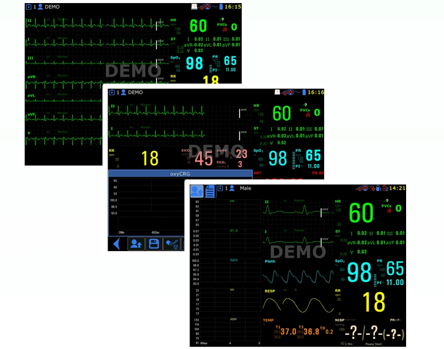 8.4-Inch Lightweight Semi-Modular Medical Capnography ICU ECG Patient Monitor for Ambulance with CE