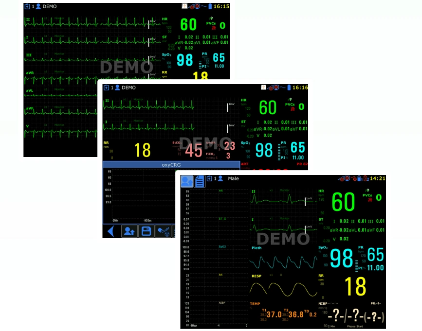 Aurora-12s 12.1-Inch Factory Price Capnography Medical Multiparameter ECG Patient Monitor