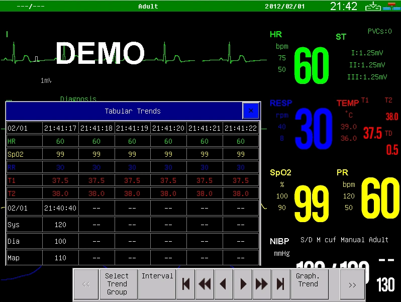 Sinnor Snp9000W 15inch ICU Patient Monitor High Piexl with ECG Resp NIBP SpO2 Temp Hr/Pr