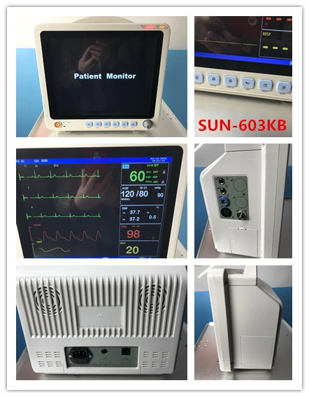 6 Parameters Patient Monitor Machine Sun 603kb