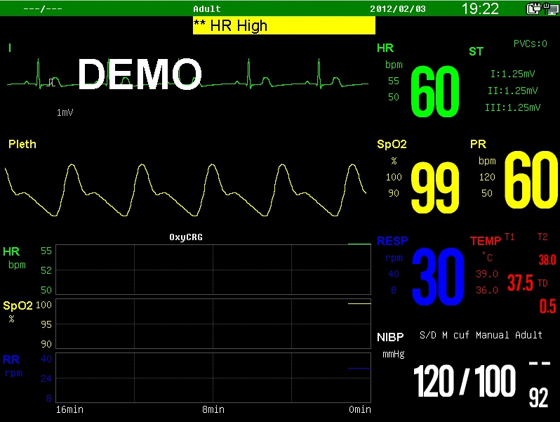 Sinnor Snp9000e Portable Multi Parameter Medical Patient Monitor Vital Signs Monitor 15 Inch Touch Screen