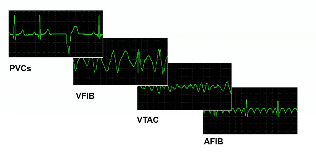 8.4-Inch Portable Semi-Modular Medical Capnography ICU ECG Patient Monitor for Ambulance with CE