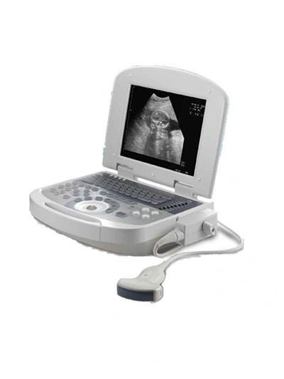 Ce Approved 10 Inches Medical Portable Laptop Fetal Monitor Ultrasound Scanner (YJ-U308)