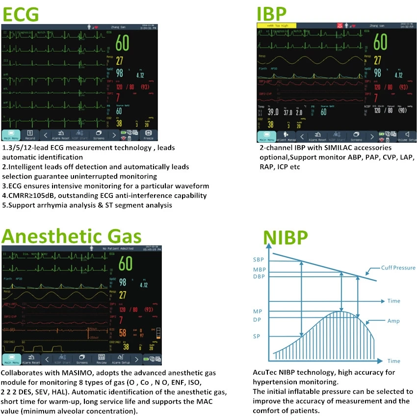 Competitive Price Patient Monitor Hospital Equipment Multi Parameter Monitor Vital Sign Monitor