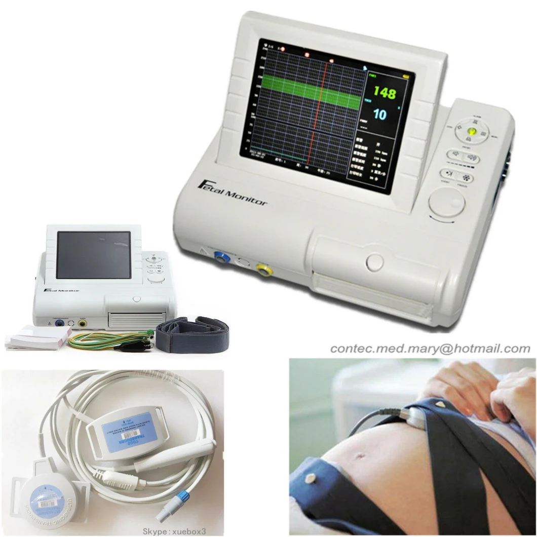 Hot Selling Cms800g Fetal Monitor Fhr Toco Fetal Movement Fetal Monitoring System2.01 Reviews
