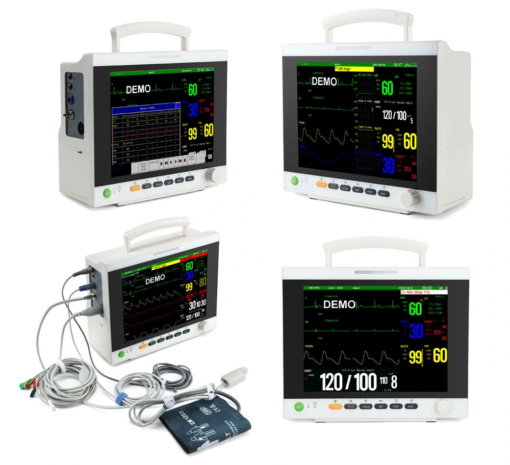 Veterinary Parameter Monitor, Vet Patient Monitor, Large Screen, Patient Monitoring System