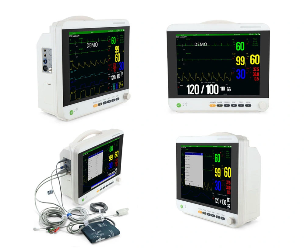 15.1 Inch LCD Display, Patient Monitoring System, Multiparameter Patient Monitoring, ECG, NIBP, SpO2, Temeperature, Respiration, with Optional Etco2, IBP