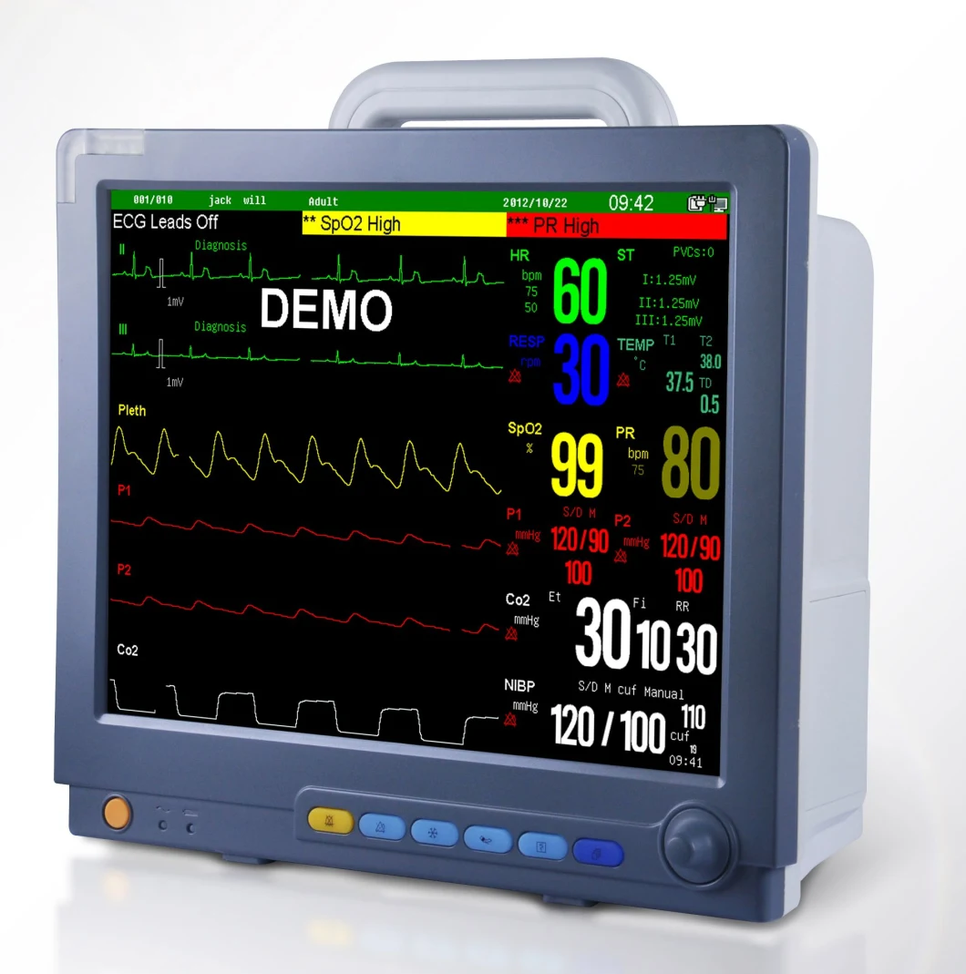 Manufacturer Hospital Portable 15' Inch Multiparameter Vital Sign ICU Bedside Patient Monitor