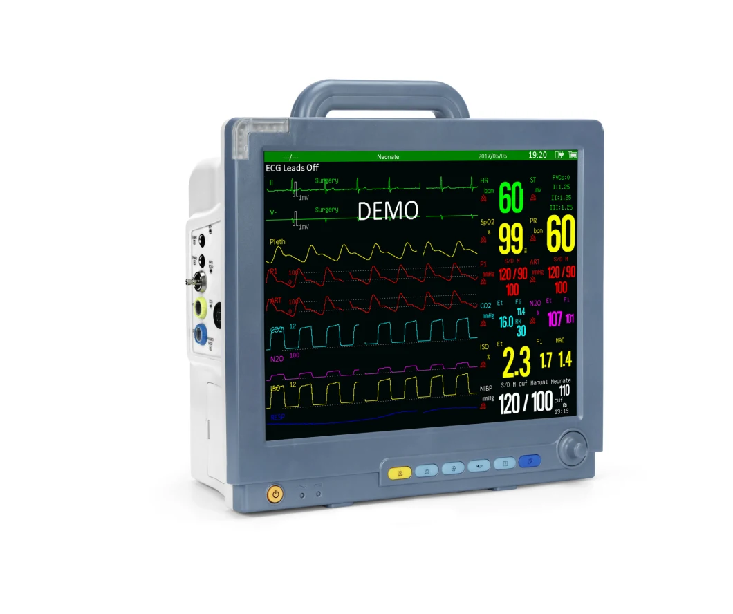 Sinnor Snp9000m 15inch Multi-Parameter Patient Monitor Portable Veterinary Monitornibp ECG Cardiac Monitor