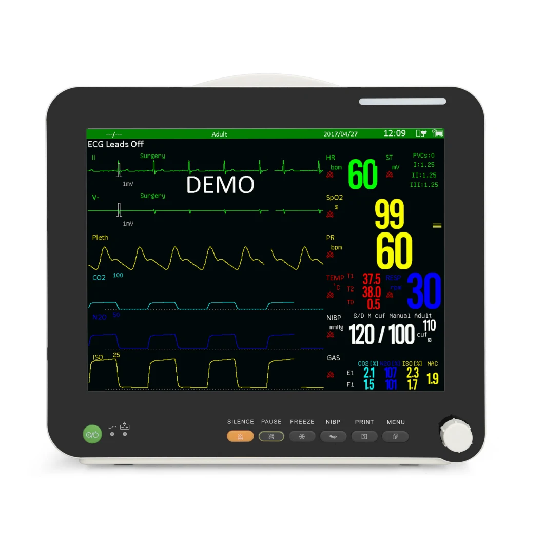 Sinnor Veterinary Monitor ECG Monitor Cardiac Monitor Ot Monitor Handheld Monitor Factory Manufacturer 15inch Snp9000ia ICU/Nicu/Ccu Monitor Bedside Monitor
