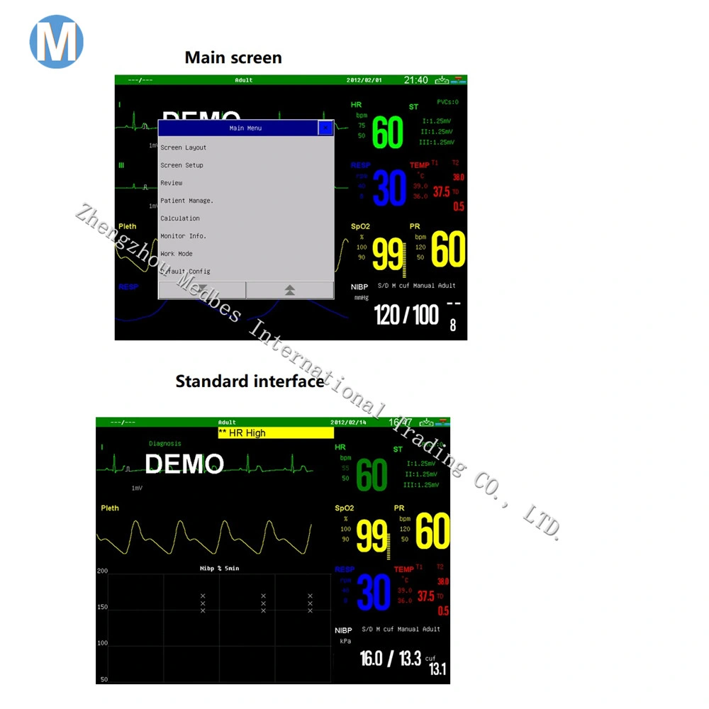 Portable ICU Cardiac Etco2 Blood Pressure Multi-Parameter Patient Monitor