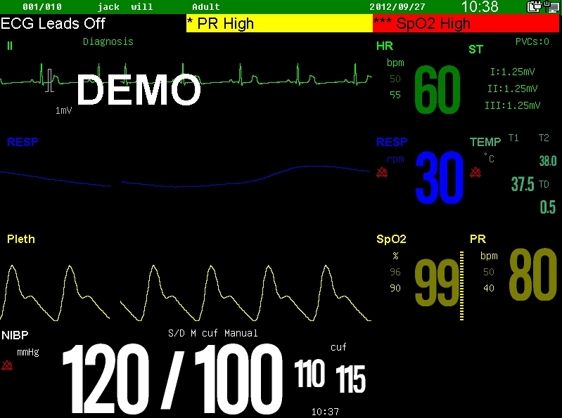 Sinnor Snp9000e Portable Multi Parameter Medical Patient Monitor Vital Signs Monitor 15 Inch Touch Screen