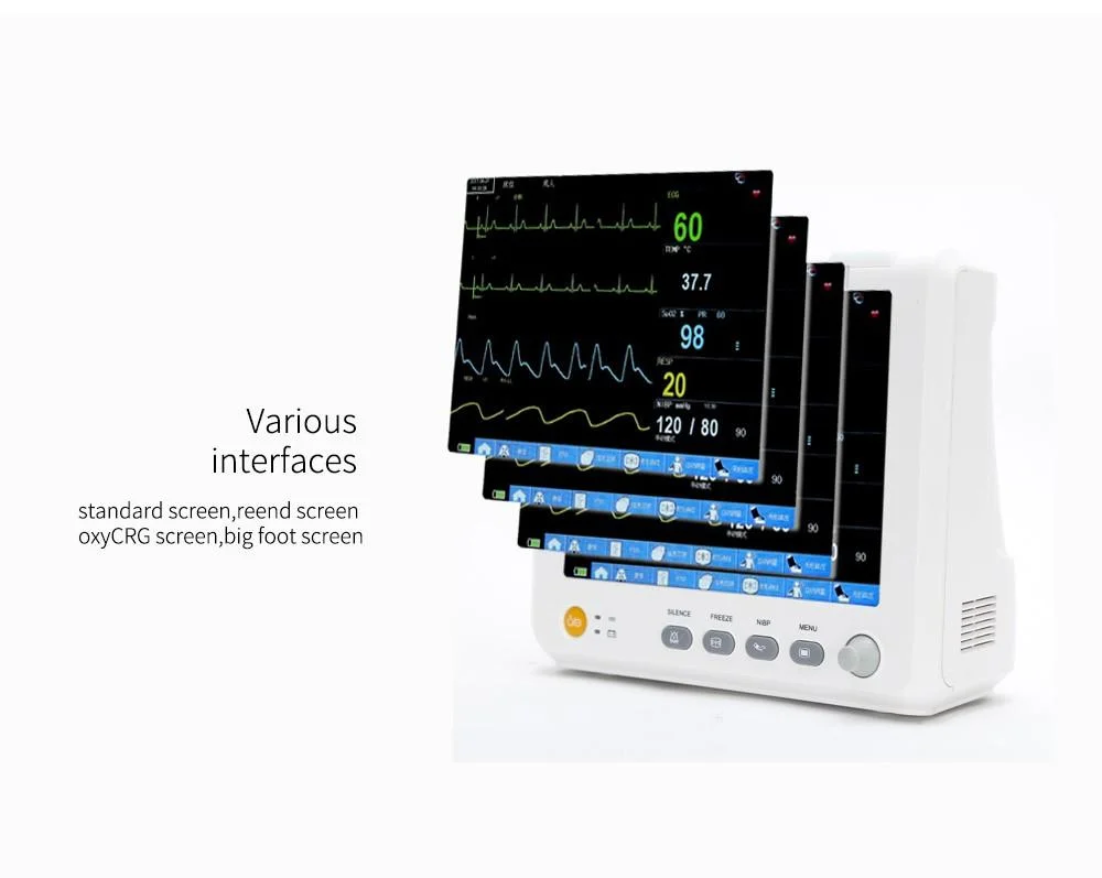 15 Inch Up9000 Multi-Parameter Patient Monitor NIBP, SpO2, Pr, ECG, Resp, Temp with FDA