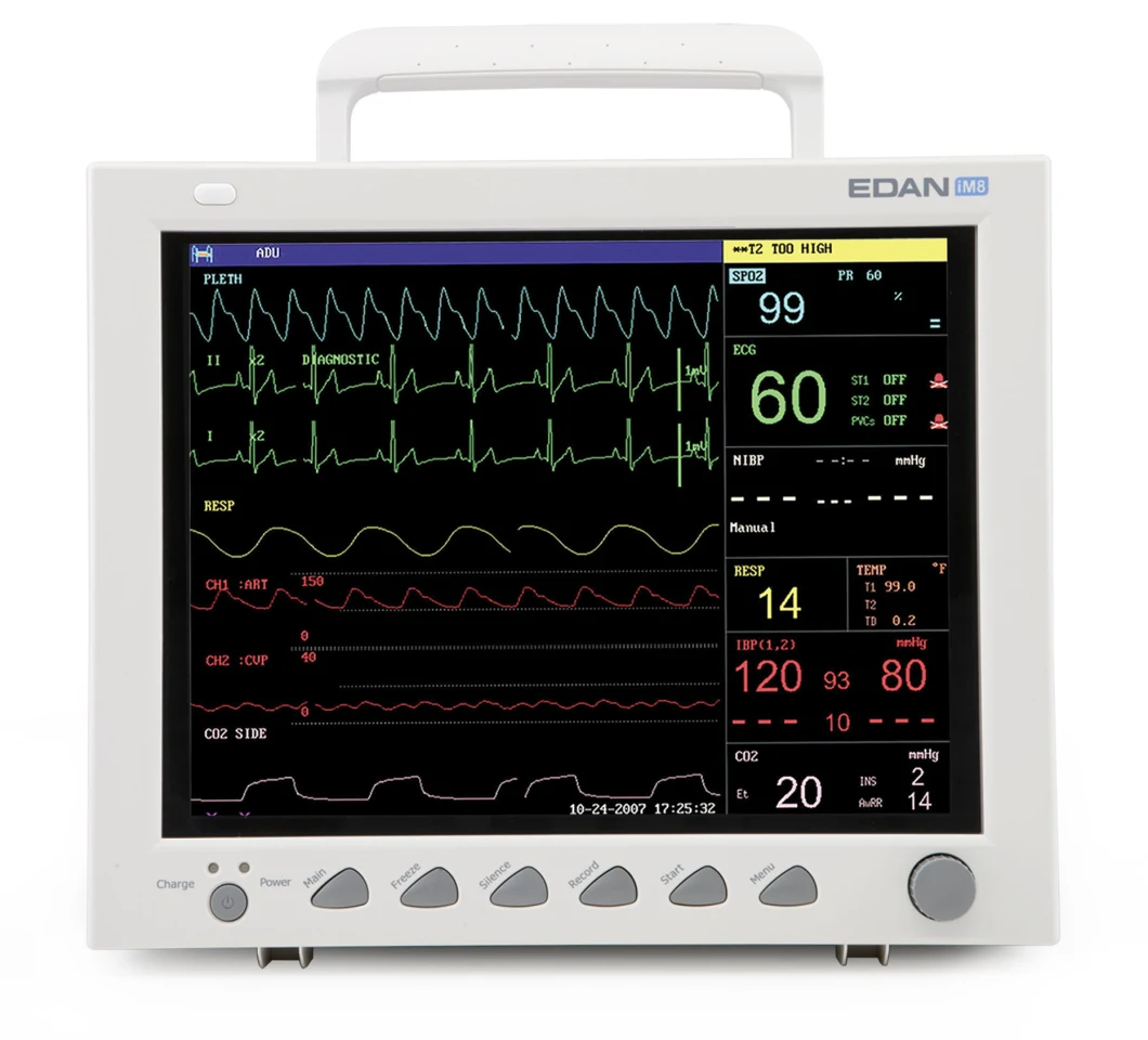 Reliable Monitoring Technologies Patient Monitor Im8 with Color TFT-LCD Screen Monitor