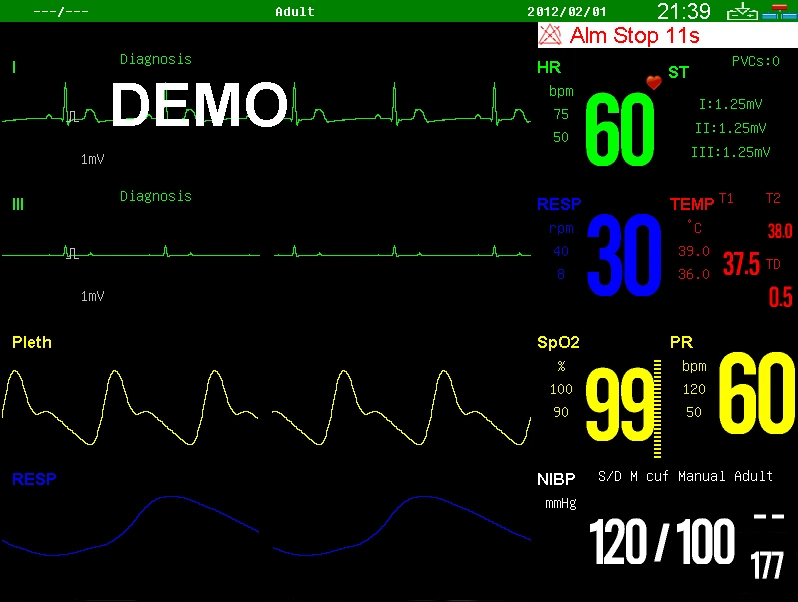 Sinnor Snp9000e Portable Multi Parameter Medical Patient Monitor Vital Signs Monitor 15 Inch Touch Screen