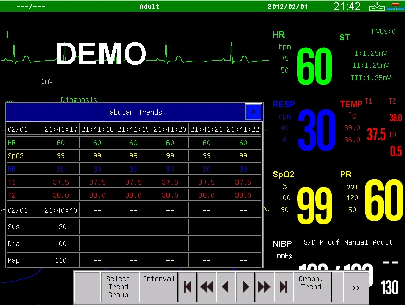 Sinnor Snp9000e Portable Multi Parameter Medical Patient Monitor Vital Signs Monitor 15 Inch Touch Screen