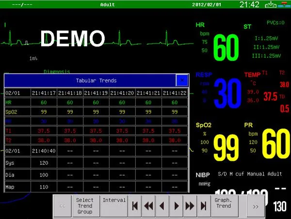 Factory Price Cheap 6 Multi-Parameters Patient Monitor/12 Inch Patient Monitor Price (MSLMP15)