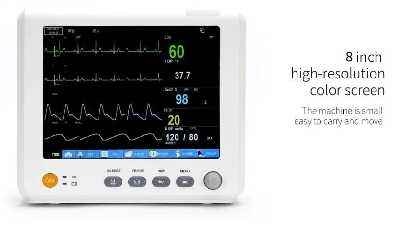 15 Inch Up9000 Multi-Parameter Patient Monitor NIBP, SpO2, Pr, ECG, Resp, Temp with FDA