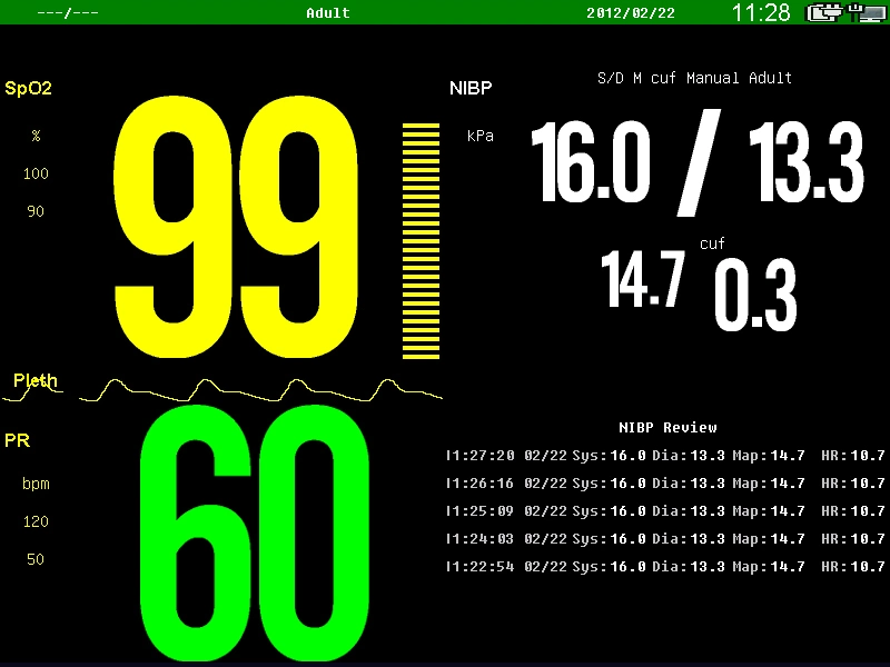 Sinnor Snp9000e Portable Multi Parameter Medical Patient Monitor Vital Signs Monitor 15 Inch Touch Screen