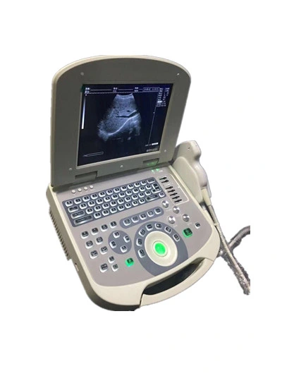 Ce Approved 10 Inch Medical Clinical Laptop Portable Fetal Monitor Ultrasound System (YJ-U308)