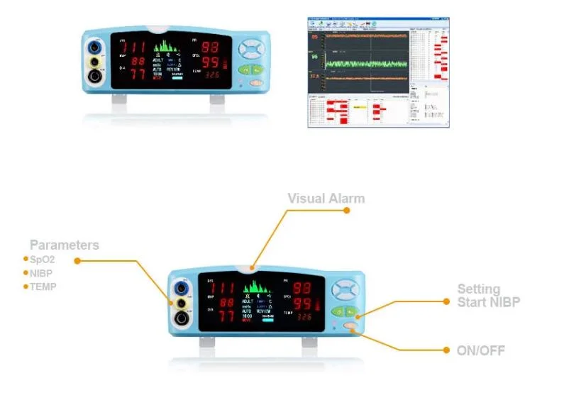 Medical Equipment Patient Monitor, Vital Signs Monitor, ECG Monitor (PW-303T-4)