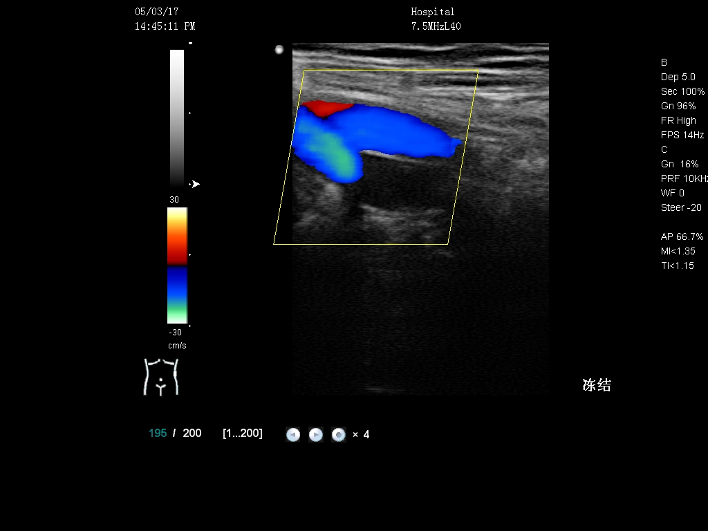 15 Inch Medical Device 3D Color Fetal Monitor Trolley Ultrasound Scanner (YJ-U10T)