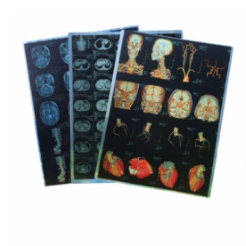 Roll Packing Blue Thermal Medical Digital Dry Images