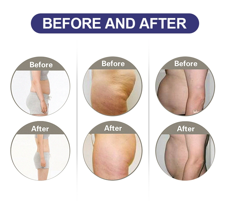 Newest Cavitation Body Slimming Equipment Cryotherapy Body Slimming Equipment Beauty Instrument