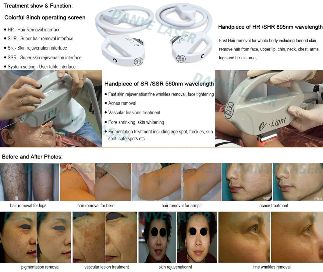 Skin Care Machine Beauty Equipment Opt Sapphire Crystal Painless Hair Removal Elight Shr Depilacin Permanente