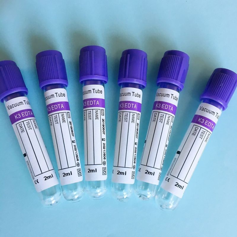 Caps Serum Separating Gel Rubber Stopper Vacutainer Tube for Blood Collection