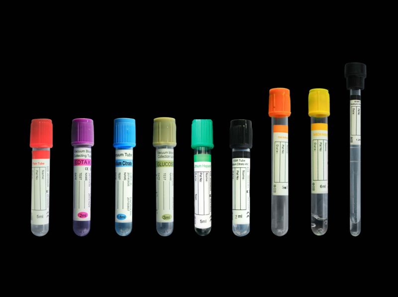 ESR Vacuum Collection Test Tube with Sodium Citrate