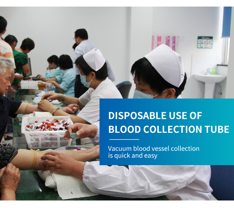 Hot Selling Blood Collection Tube Vacuum Blood Collection Plain Tube Serum Gel Clot Activator Tube