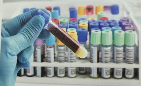 Disposable Vacuum to Collect Blood Vessels with Green Black Tube