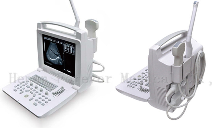 96elements High Quality B Ultrasound Scanner for Thyroid Abdomen